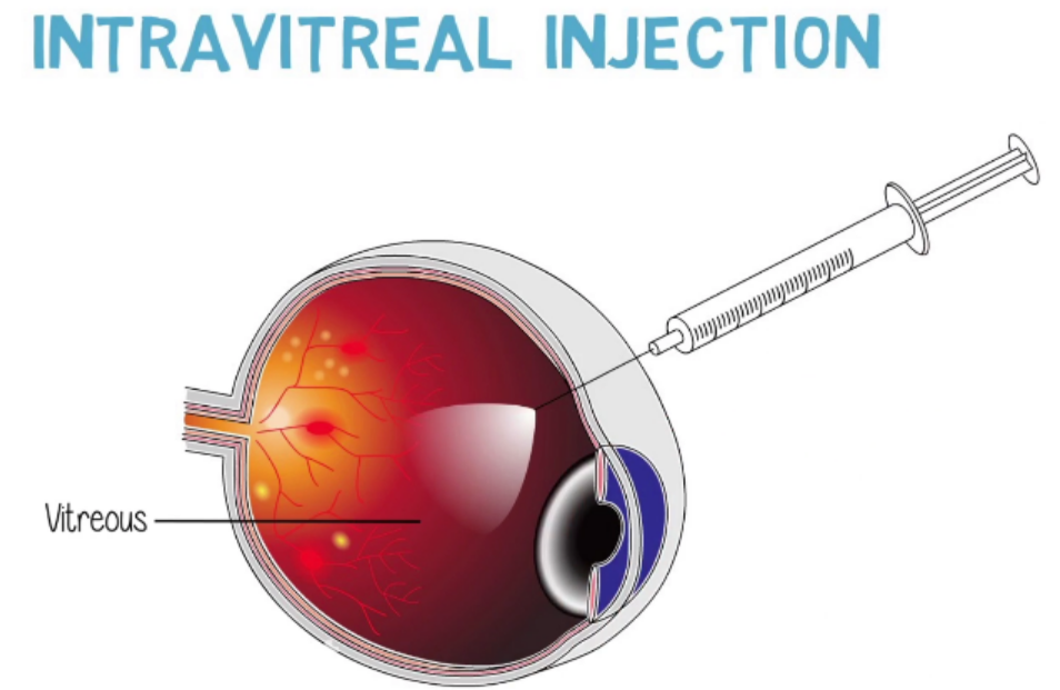 Eye Anatomy